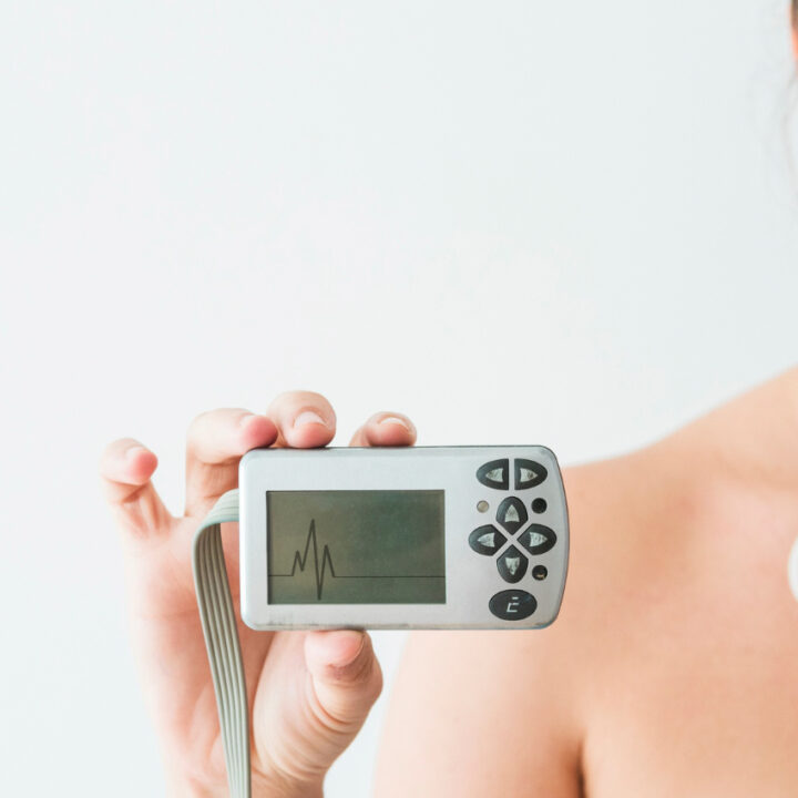 Holter EKG Poliklinika Medikol - Poliklinika Medikol Holter EKG Poliklinika Medikol
