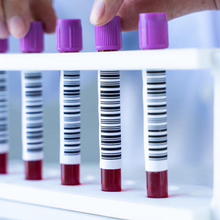 Sedimentacija eritrocita