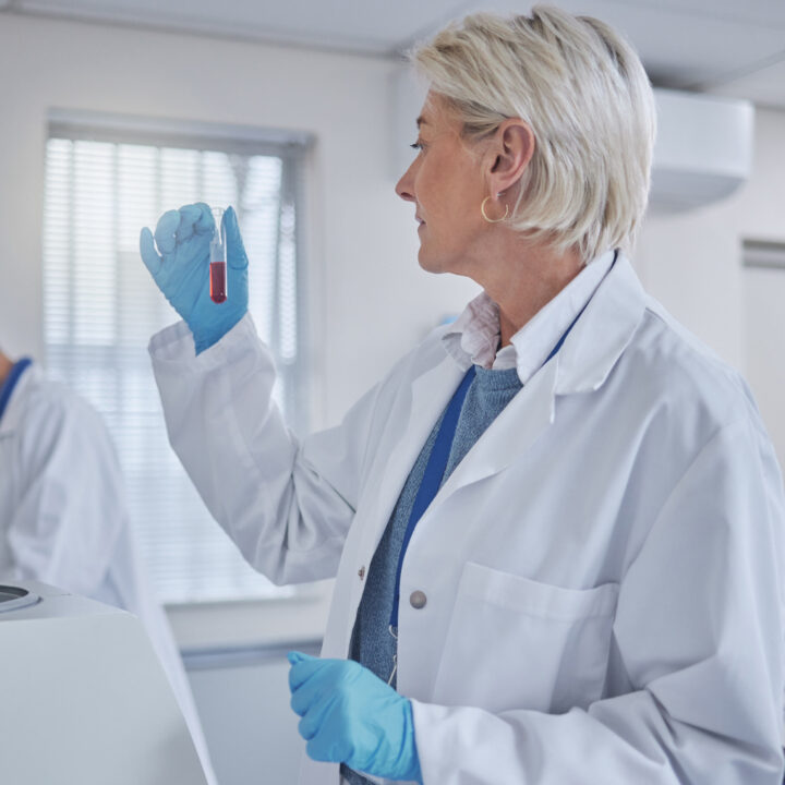 laboratorijska obrada štitnjače Medikol