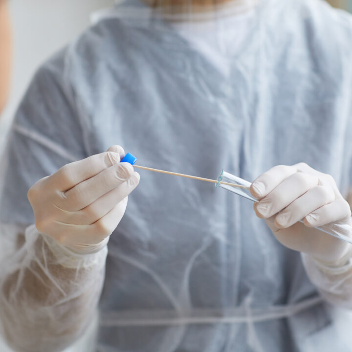 Bris nazofarinksa Poliklinika Medikol