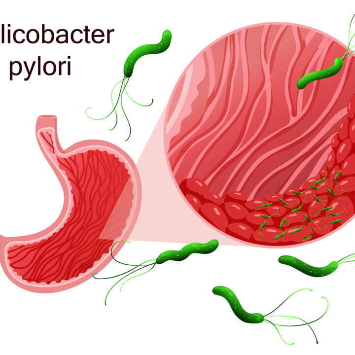 Helicobacter pylori
