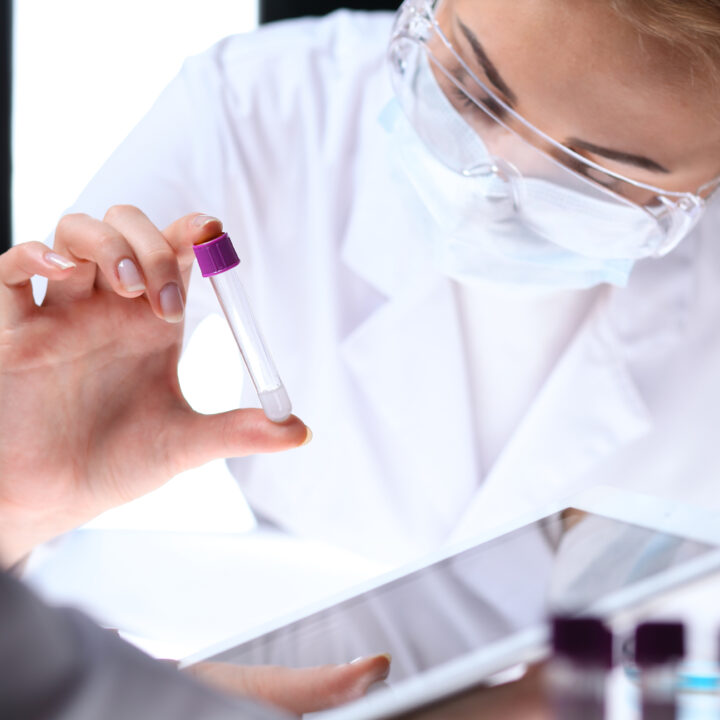 imunoelektroforeza, imunofiksacija