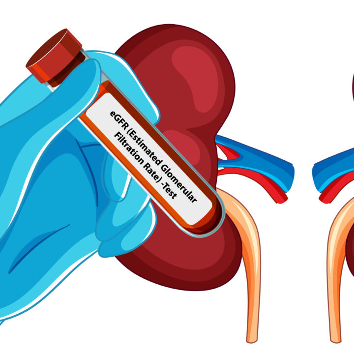 eGFR Procjena glomerularne filtracije