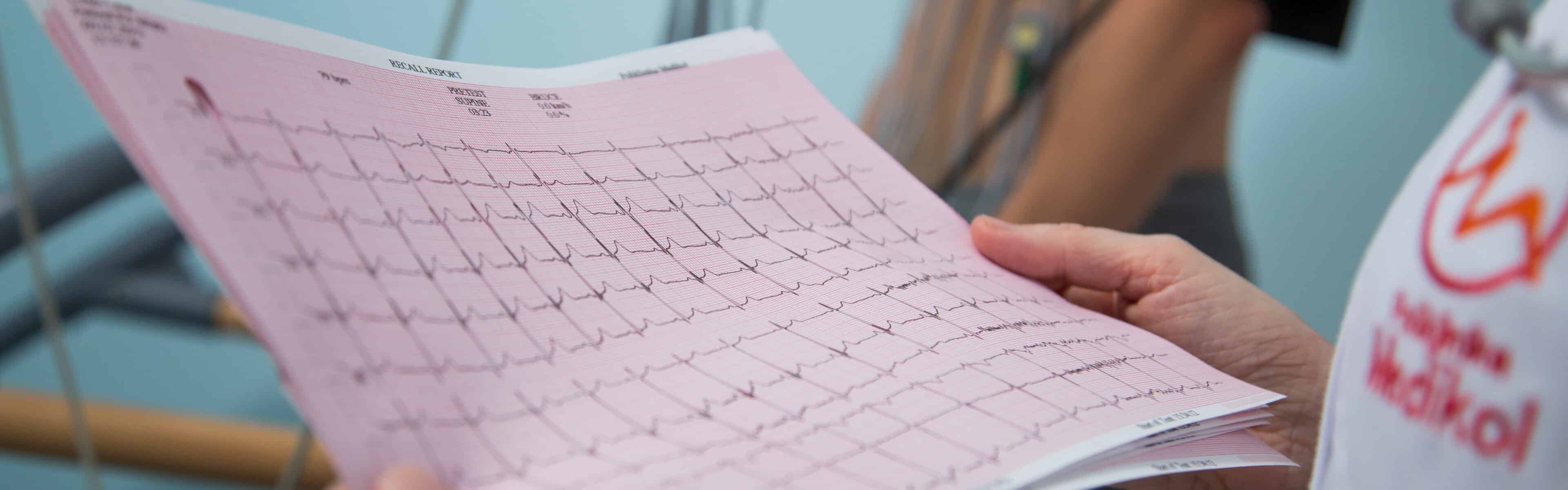 EKG s očitanjem internistički pregled