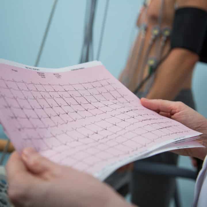 EKG s očitanjem internistički pregled