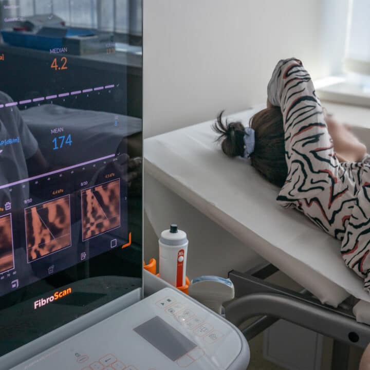 neinvazivna dijagnostika jetre fibroscan