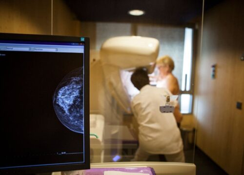 Vakuum asistirana biopsija