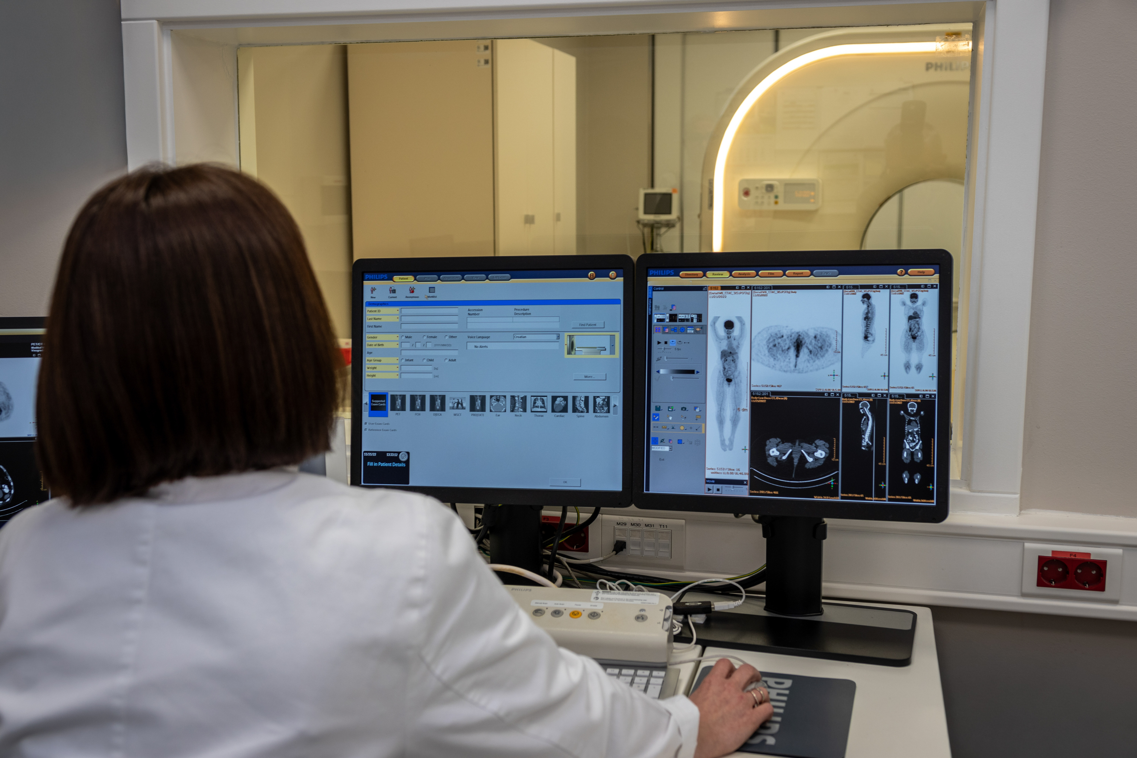 PET CT snimanje Medikol - Poliklinika Medikol PET CT snimanje Medikol